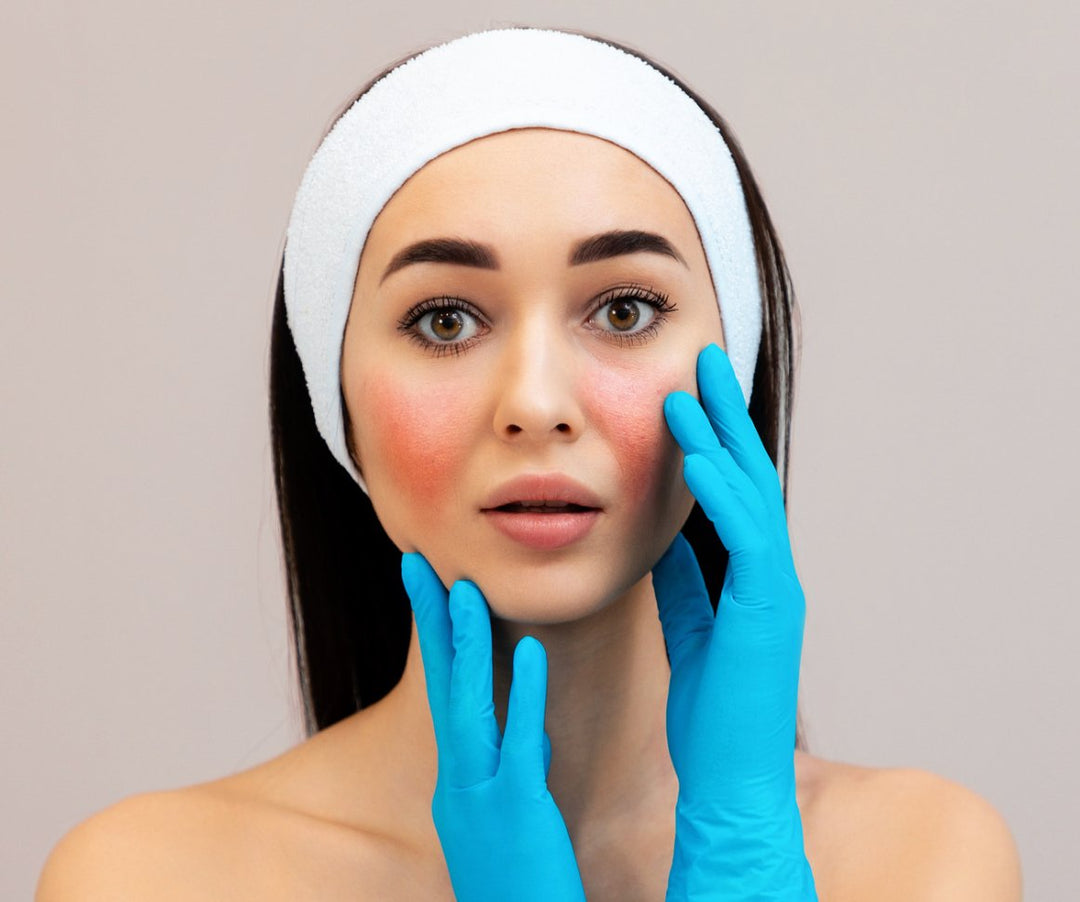 Is Skin Irritation Really that Bad? - No Face Skincare