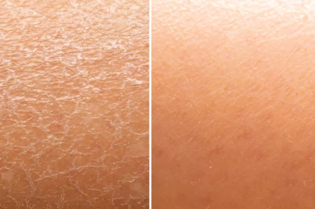 ACTIVITA® Vital Cream - No Face Skincare