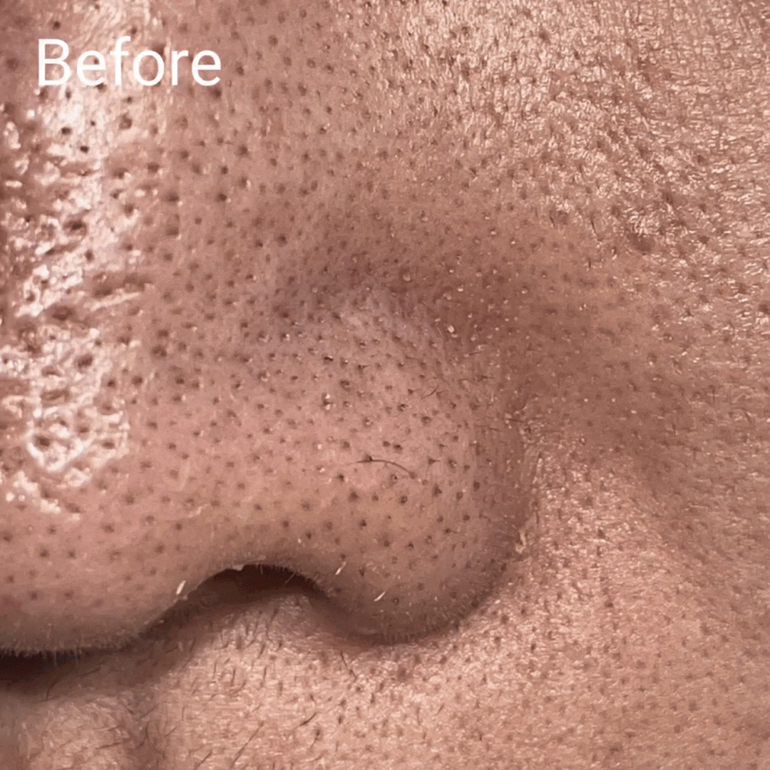 Clarifier High Definition Hydro Exfoliator - No Face Skincare