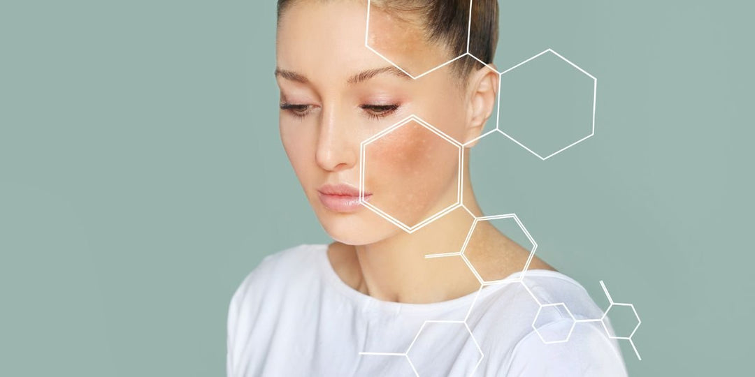 Unveiling the Secrets to Preventing Skin Pigmentation: A Comprehensive Skincare Routine - No Face Skincare